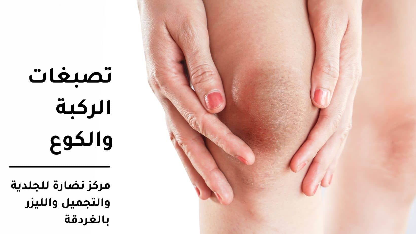 تصبغات الركبة والكوع